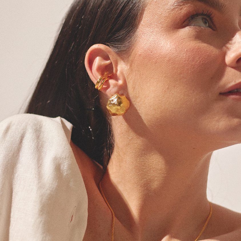 Aretes Suilus